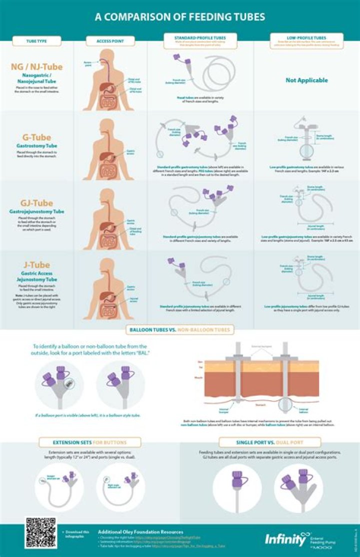 Are feeding tubes safe?