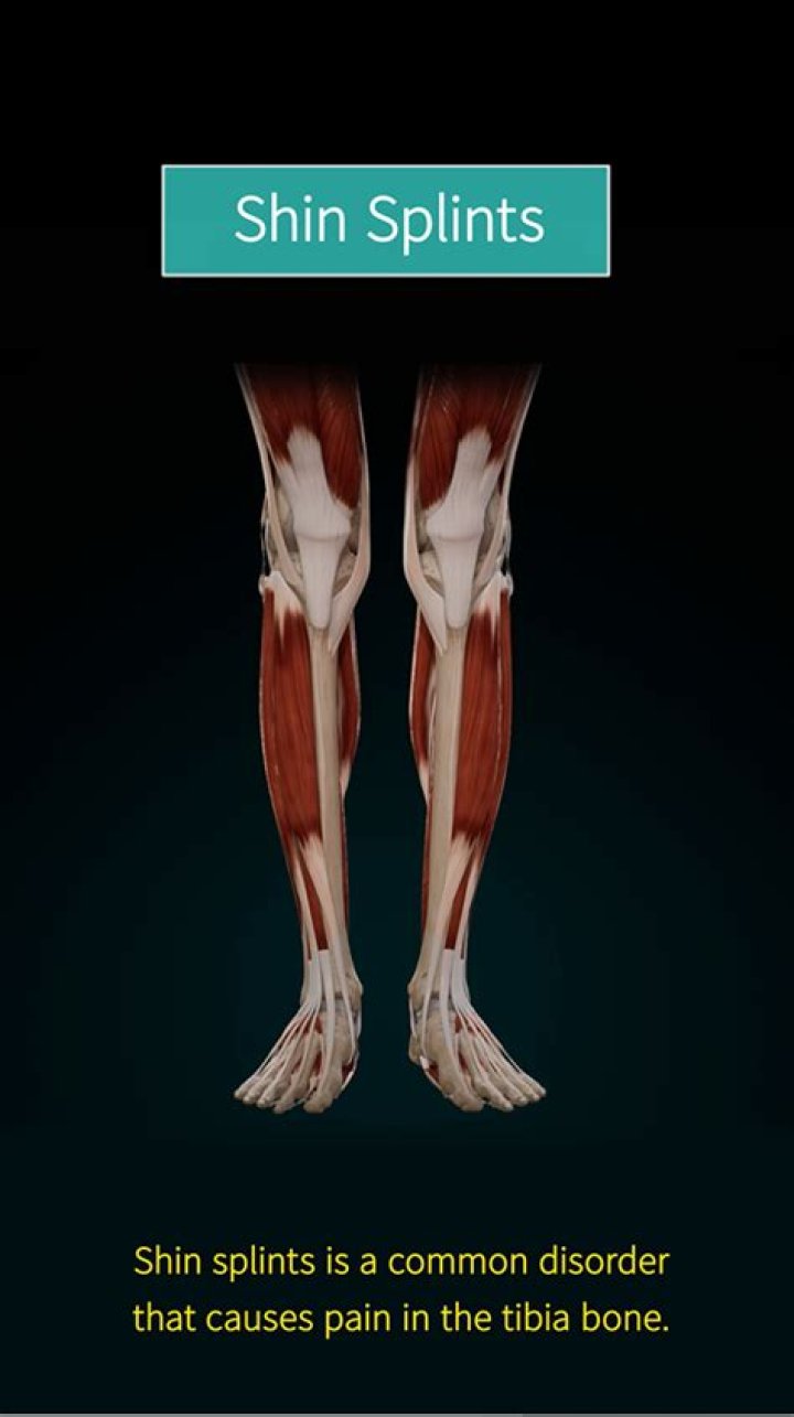 Are shin splints chronic?
