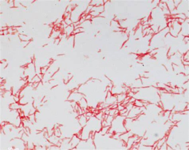 Are spirochetes bacteria or parasites?
