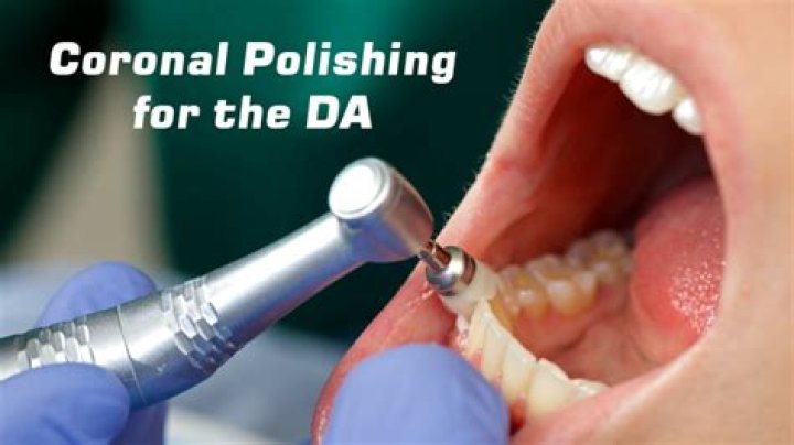 Can dental assistant do coronal polishing?