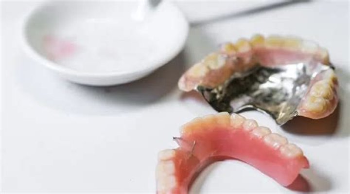 Can dentures be repaired?