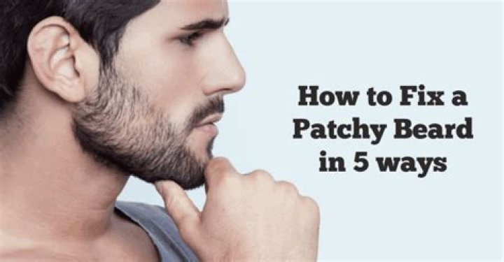 Can patchy beard be fixed?