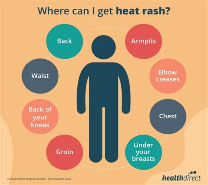 Can sweat cause a rash?