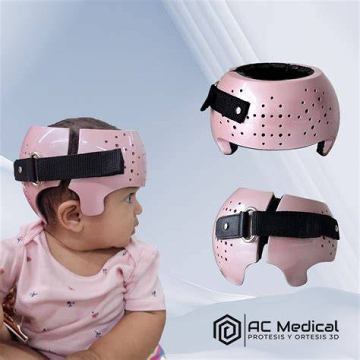 Do cranial helmets really work?