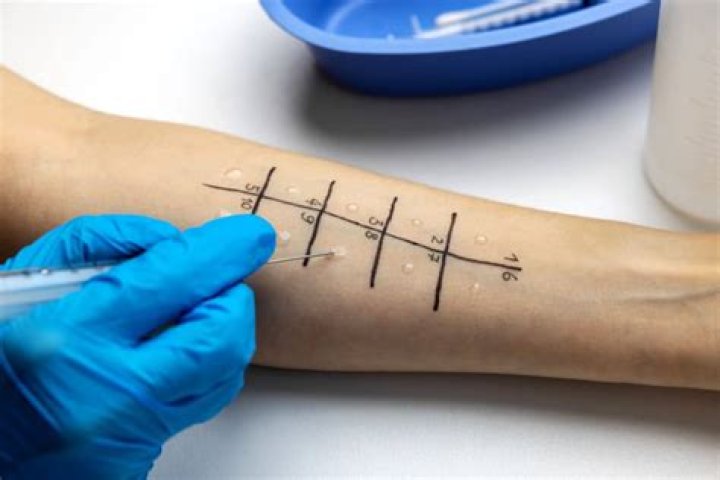 Do ent doctors do allergy testing?