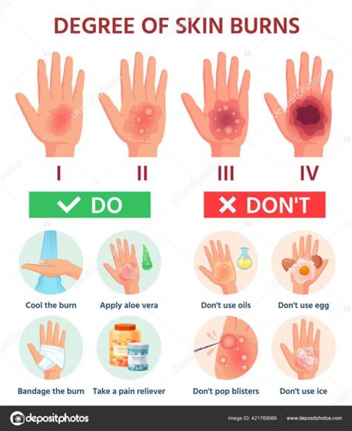 Do third degree burns blister?