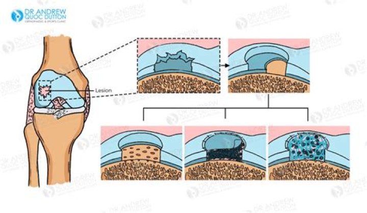 Does cartilage grow back?
