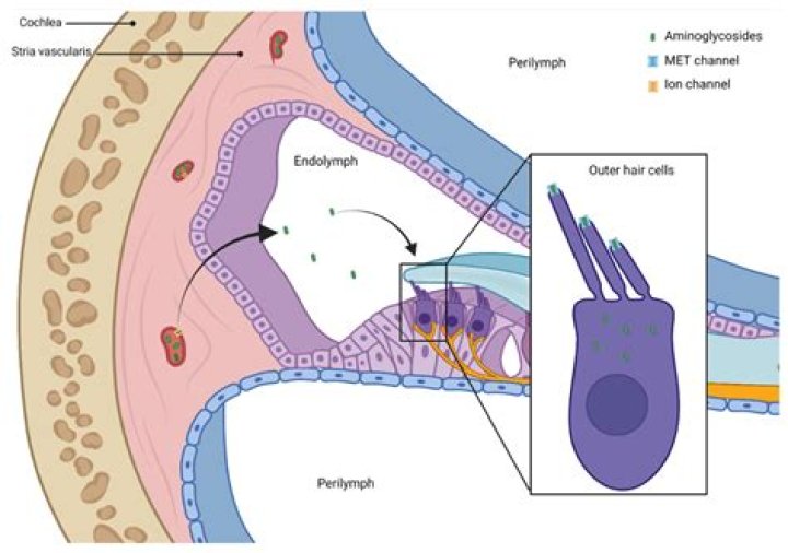 Does ototoxicity go away?