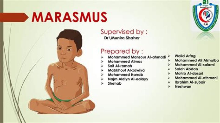 How can marasmus be treated?