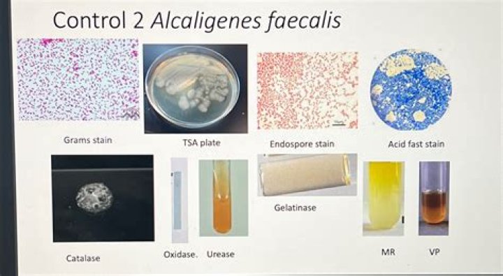 How do you get alcaligenes faecalis?