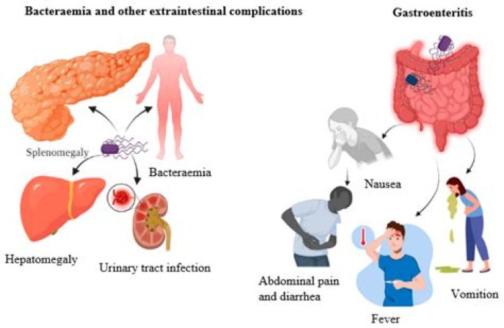 How do you get salmonella enteritidis?