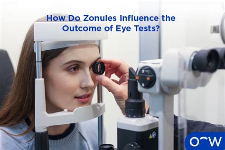 How does the zonules work?