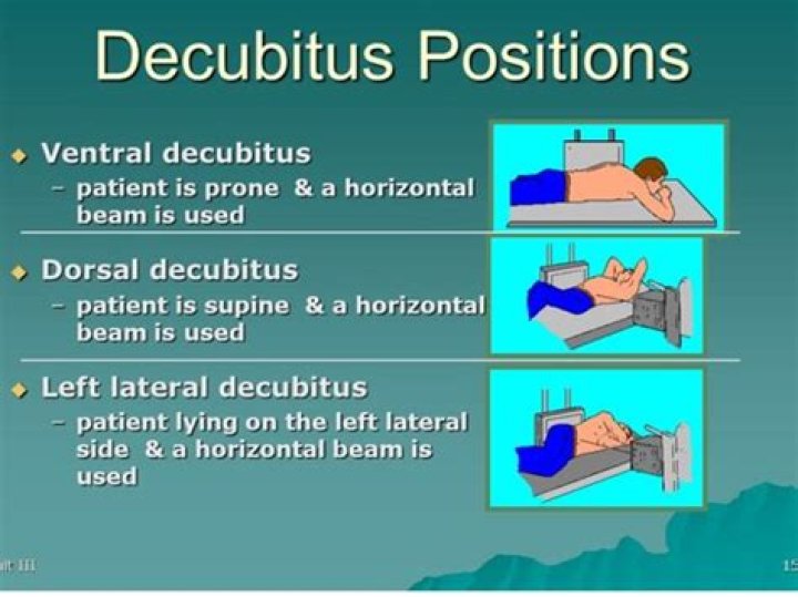 In lateral decubitus position?