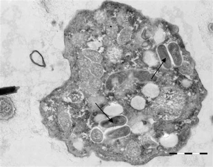 Is acanthamoeba a bacteria?