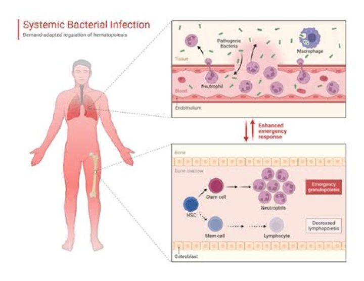 Is bacteremia a systemic infection?