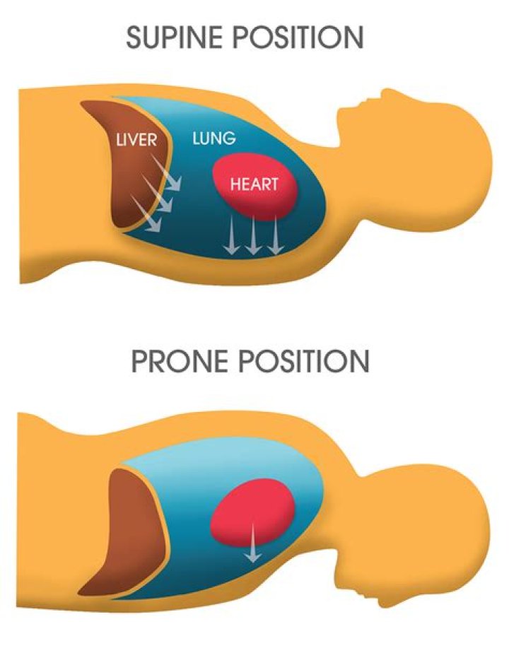 Is prone position good for covid?