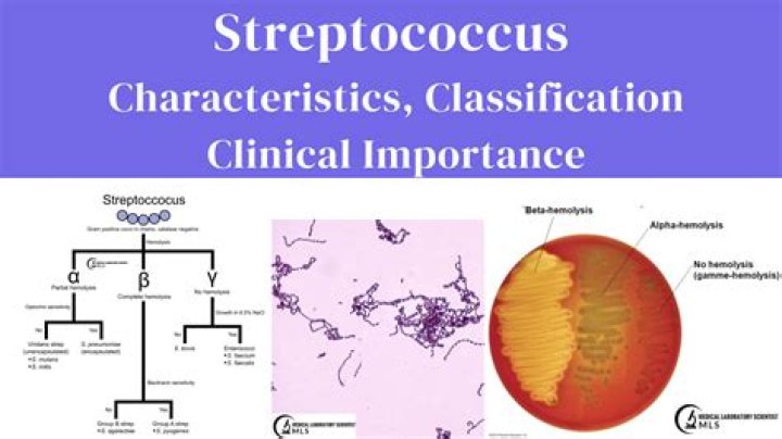Is streptococcus coagulase positive or negative?
