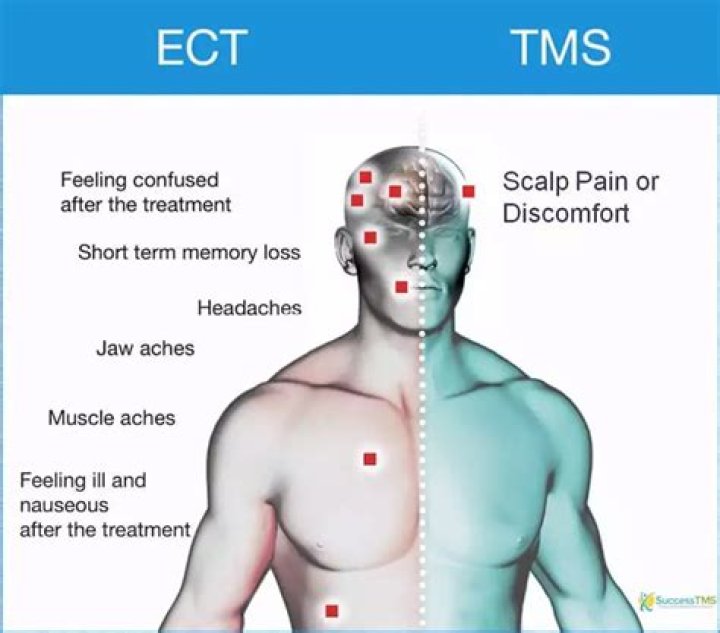 Is tms electroshock therapy?