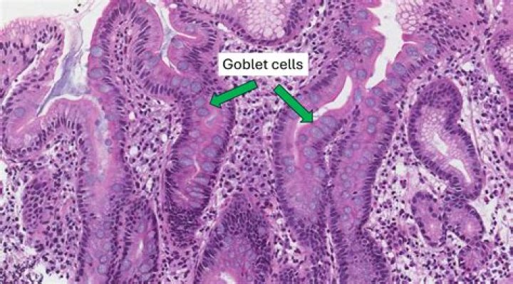 What are goblet cells?