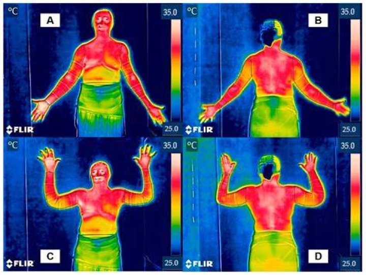 What can thermography detect?