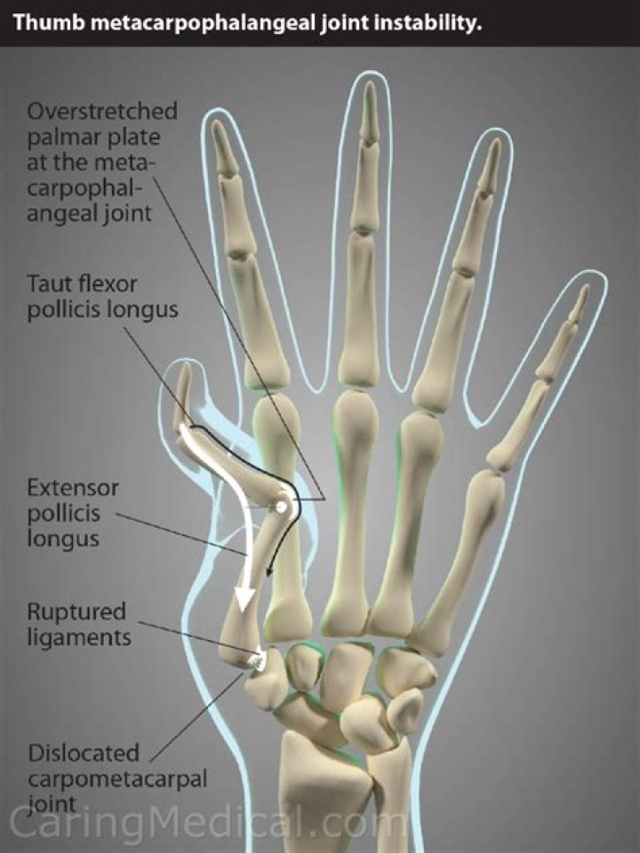 What do lines on thumb mean?