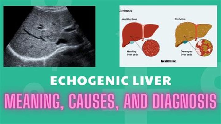 What does diffusely echogenic liver mean?