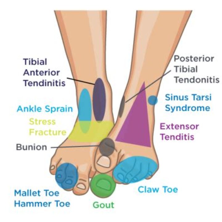 What does front foot mean?