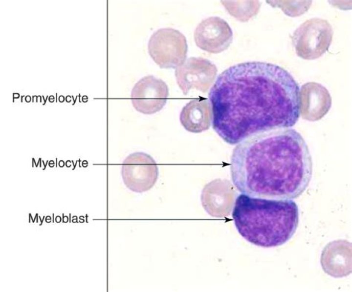 What does myeloblast mean?