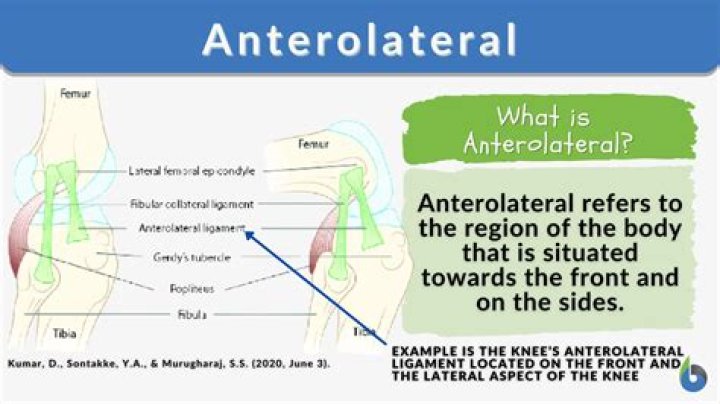 What is anterolateral thigh?