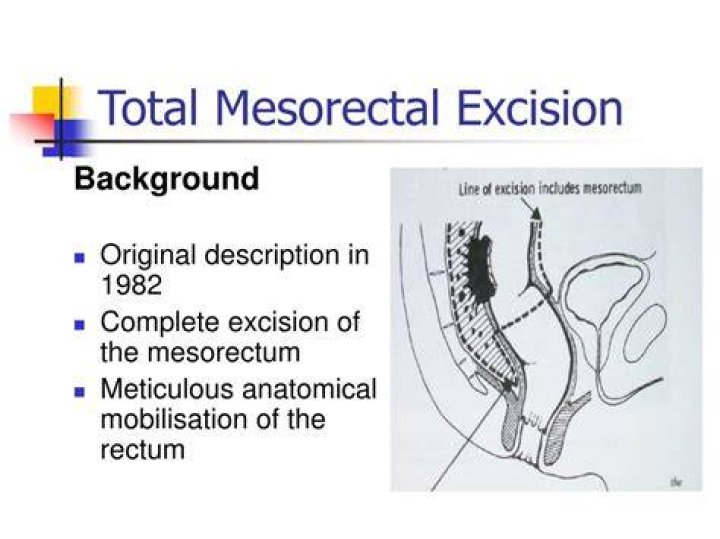 What is mesorectal excision?