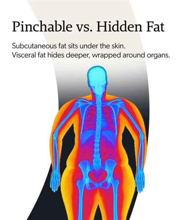 What is pinchable fat?