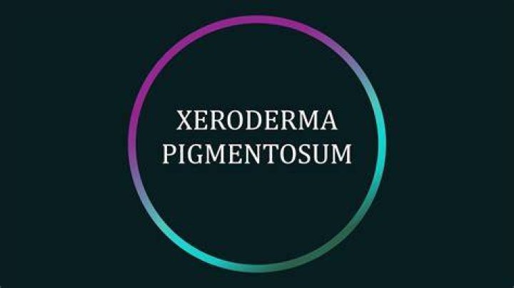 What is xeroderma pigmentosum (xp)?