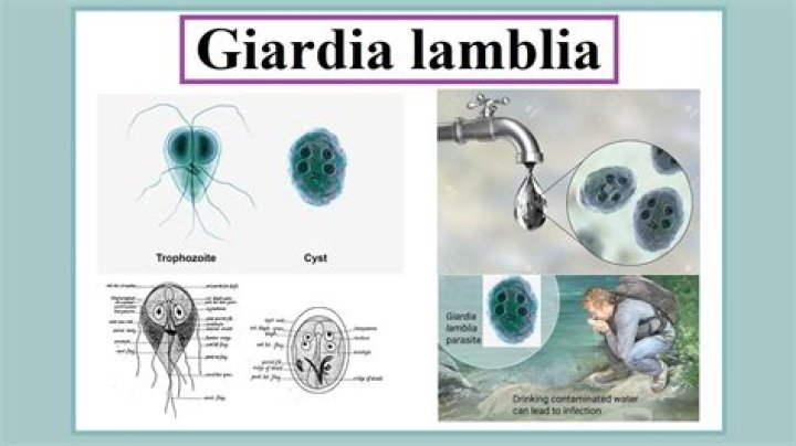 Whats a giardia lamblia?