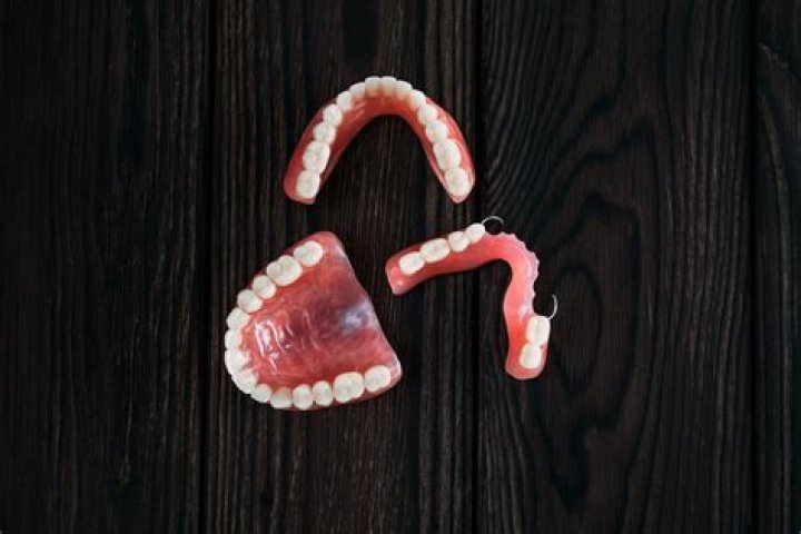 When dentures are too big?