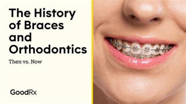 When did orthodontic start?