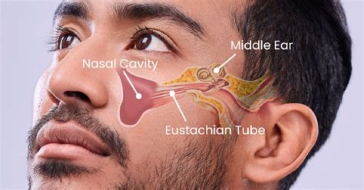 Where does earaches come from?