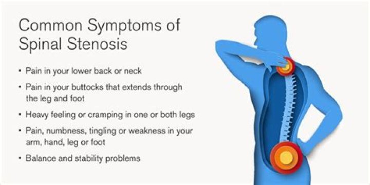 Where does stenosis occur?