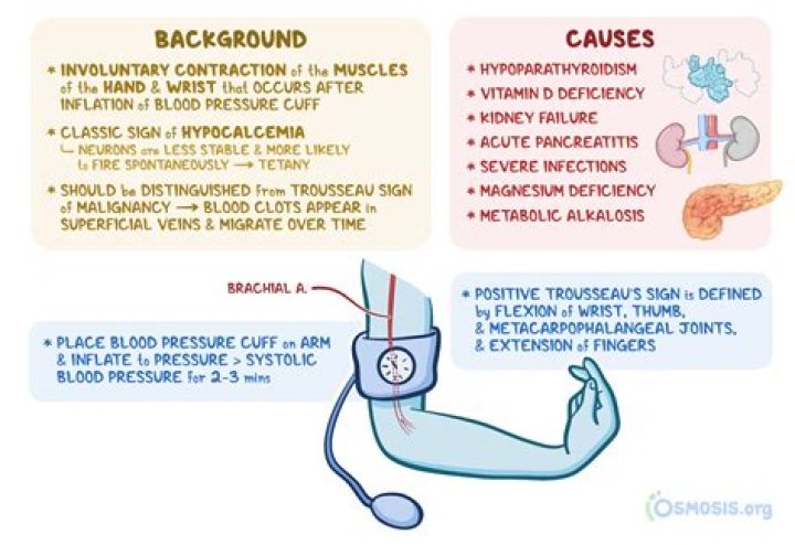 Where is carpopedal spasm?