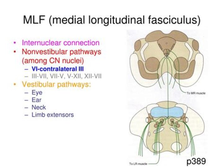 Where is mlf located?