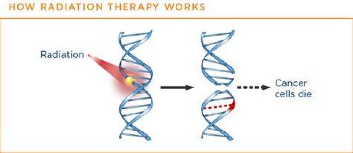 Where is radiotherapy done?
