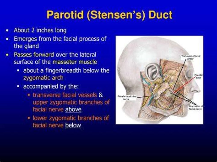 Where is the stensen duct located?