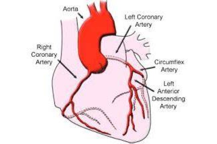 Where is widow maker artery?