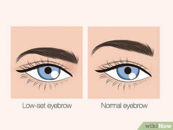 Why are my eyebrows so low?