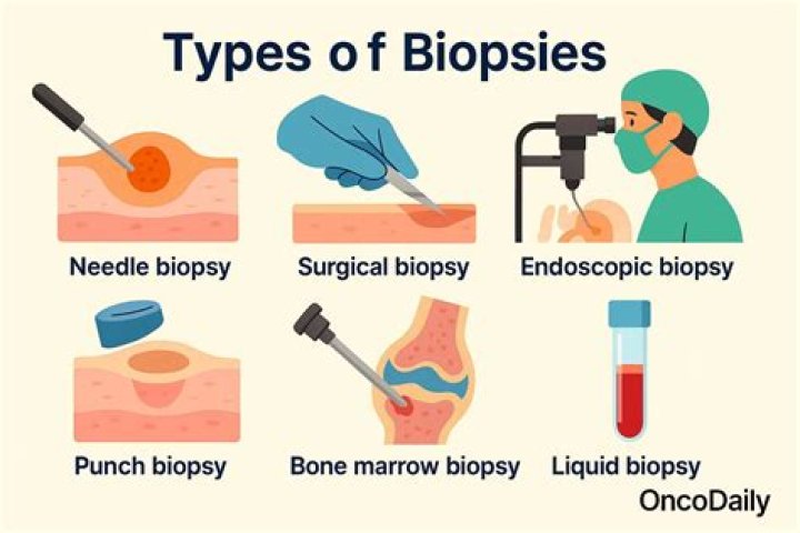 Why biopsy during endoscopy?