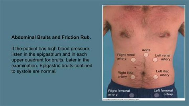 Why check for bruits?