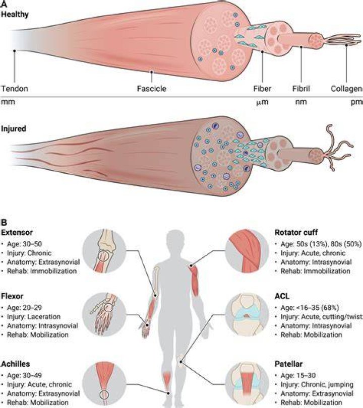 Why tendons are poorly vascularized?