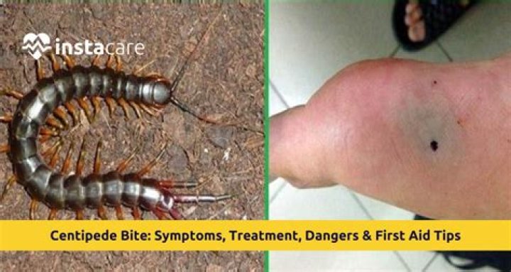 Will a centipede sting you?