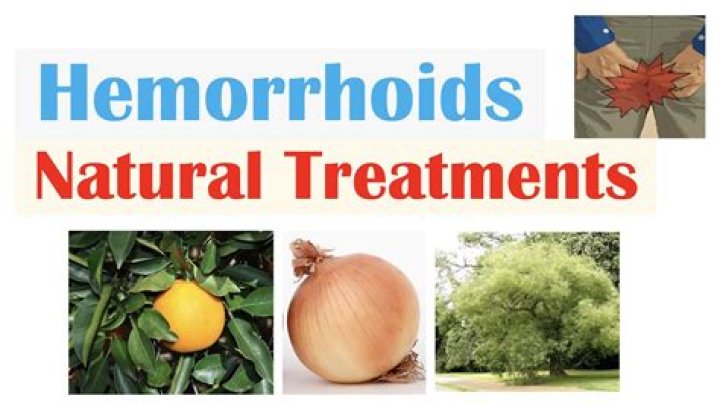 Will haemorrhoids go away?